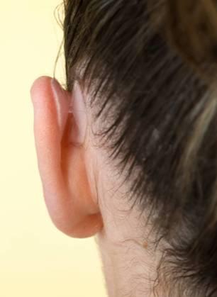Un corrector estético de orejas ideado por una empresa extremeña recibe un premio nacional de 25.000 €