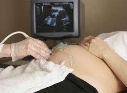 El SES elabora una estrategia para la atención al parto normal que se aplicará en todos los centros sanitarios