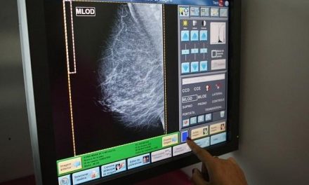 Casi 7.000 extremeñas están citadas para someterse a mamografías en el mes de septiembre