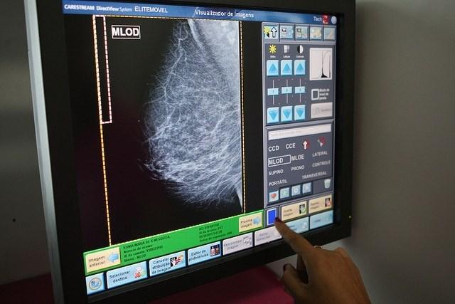 Casi 7.000 extremeñas están citadas para someterse a mamografías en el mes de septiembre