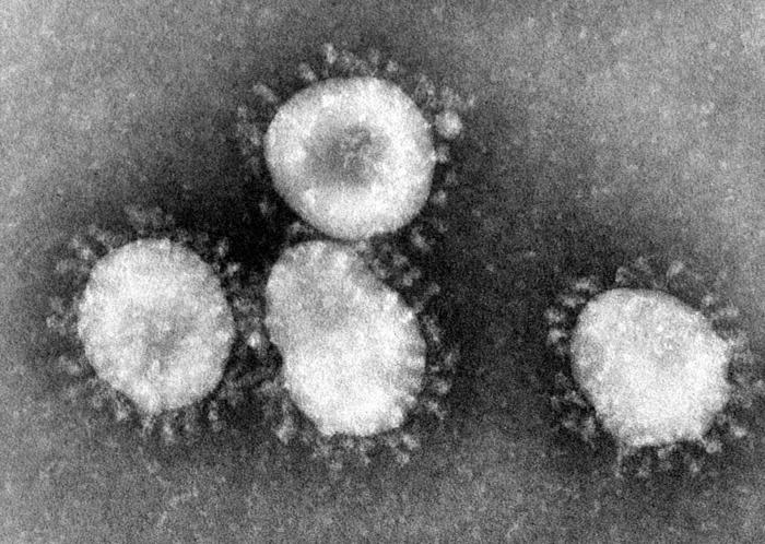 Los casos positivos de coronavirus en Extremadura suben a 95 y 3 de ellos son del Área de Salud de Coria