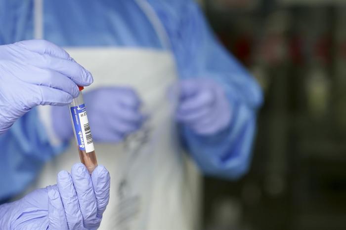 CSIF ve «insuficiente» que sólo se realicen test de coronavirus a trabajadores con sospechas de contagio