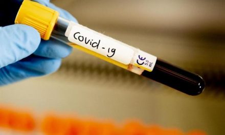 Extremadura tiene capacidad para realizar 4.000 pruebas PCR diarias para detectar el coronavirus