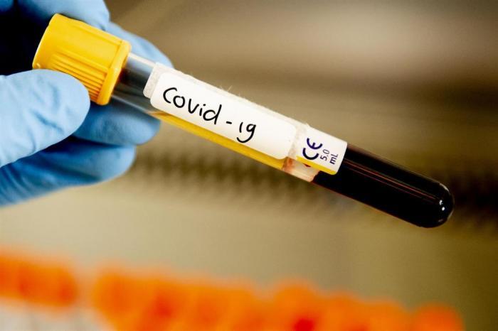 El Área de Salud de Cáceres registra un nuevo caso positivo de Covid-19  confirmado por PCR