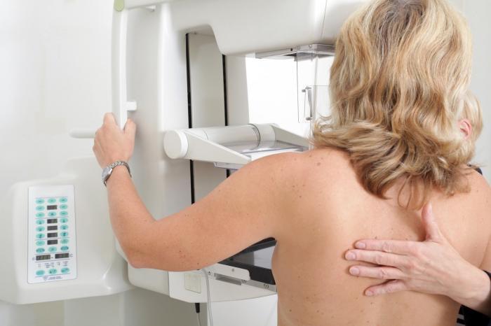 El SES cita a más de 6.000 mujeres para hacerse mamografías suspendidas por la crisis del coronavirus