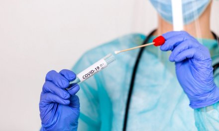 Extremadura detecta en sólo 24 horas 308 nuevos casos de coronavirus