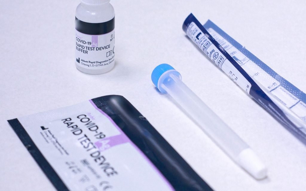 Las farmacias extremeñas vendieron 3.614 test antígenos del 18 al 25 de julio